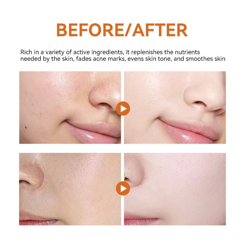 Turmeric Facial Hydrating Care Mask - Image 2