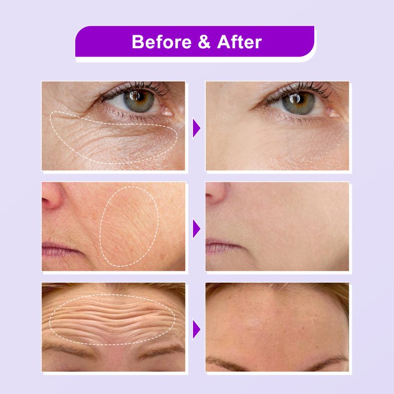 Facial Skin Moisturizing Soft Lotion Serum - Image 5