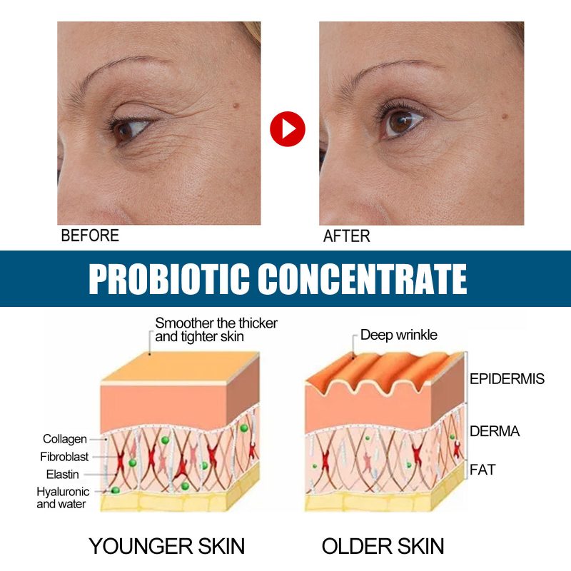 Anti-wrinkle Probiotics Concentrated Serum - Image 2