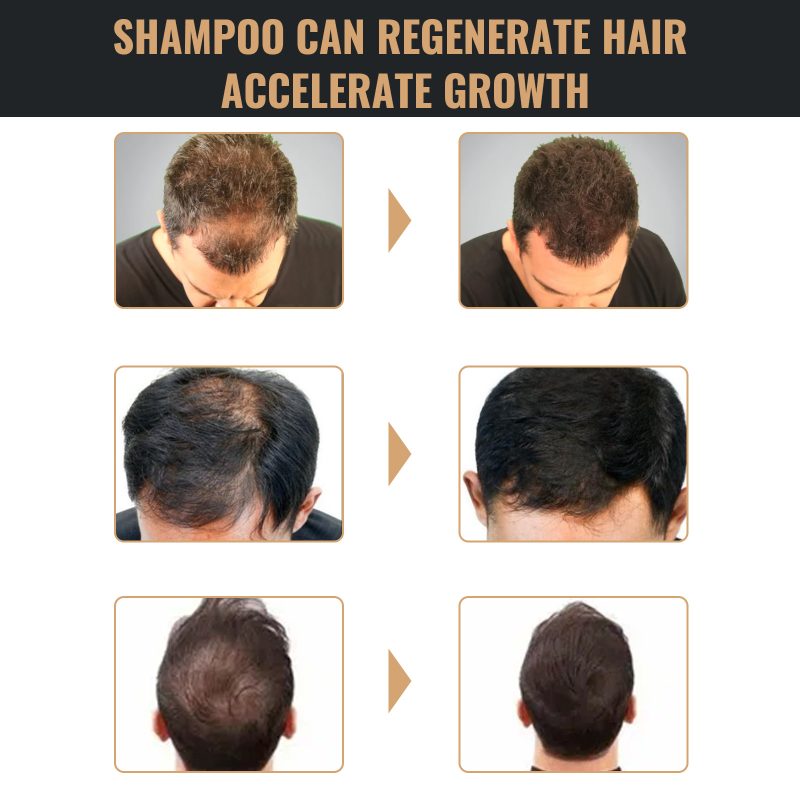 Natural Hair Regrowth Root Activator Shampoo - Image 10