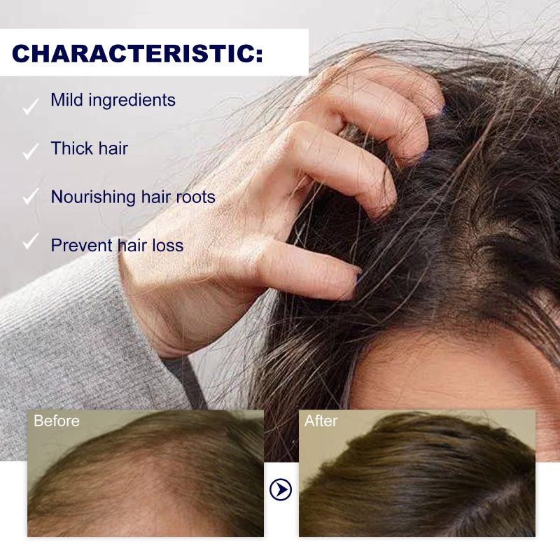Moisturizing Hair Root Roller - Image 5