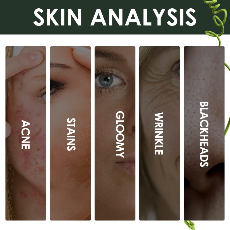 Acne Marks Blackhead Brightening Skin Serum - Image 3