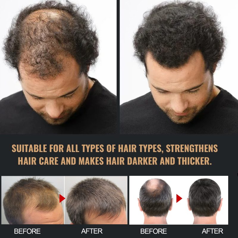 Natural Hair Regrowth Root Activator Shampoo - Image 7
