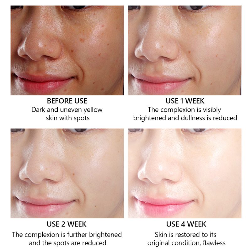 Vitamin C Women's Facial Serum - Image 5