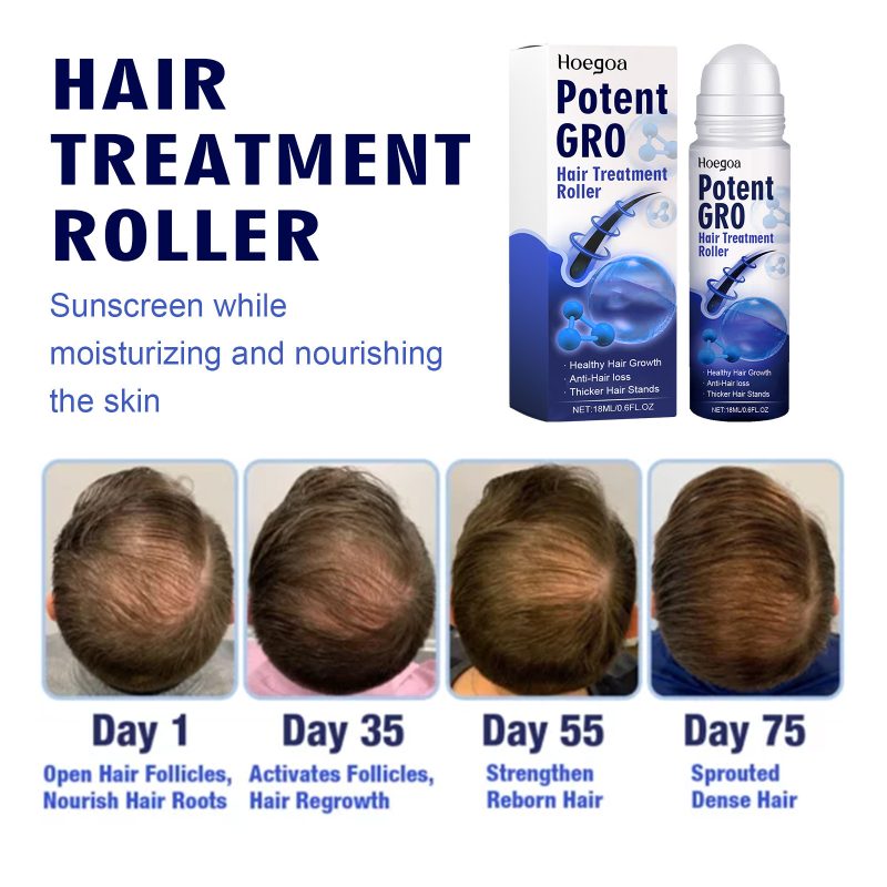 Moisturizing Hair Root Roller - Image 10