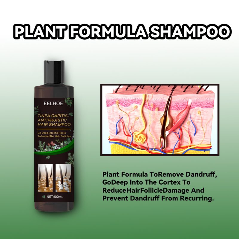 Anti-Dandruff Shampoo For Scalp Itching - Image 9