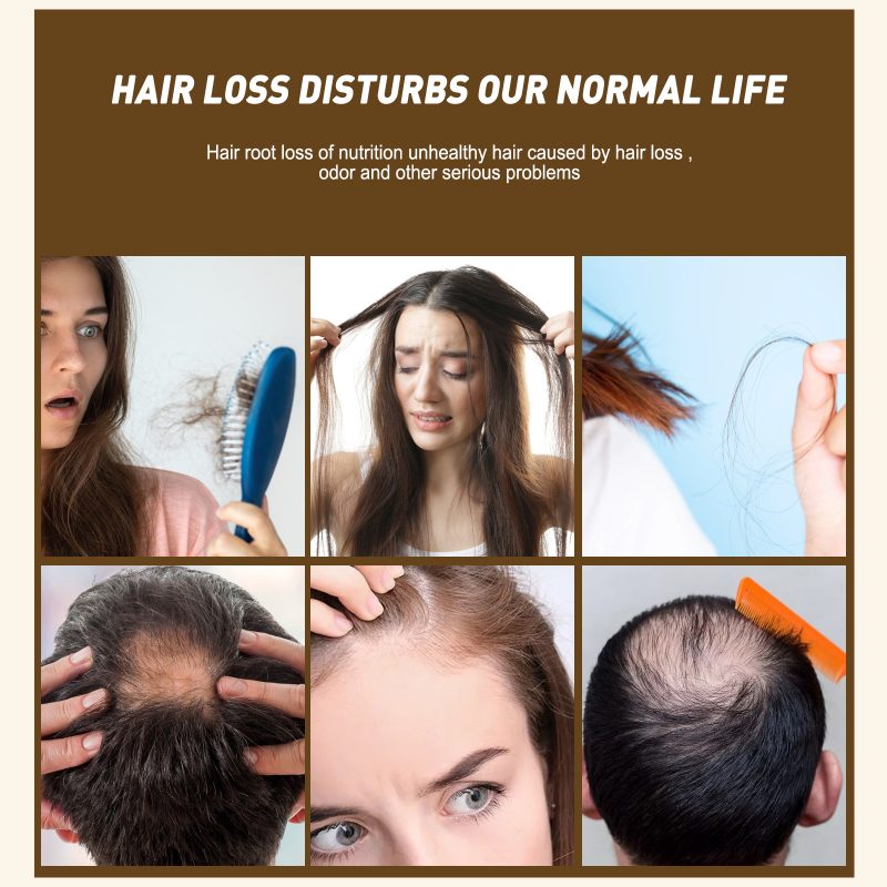 Anti-dropping Ginger Shampoo Oil - Image 5