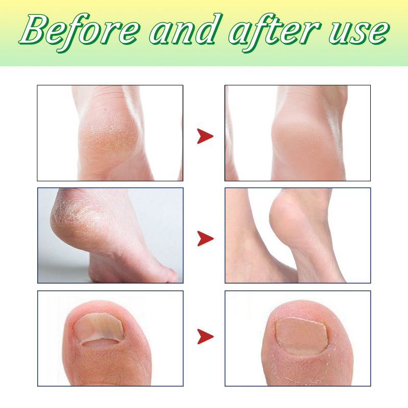 Foot Cleaning Care Sleep Bath Tablets - Image 5