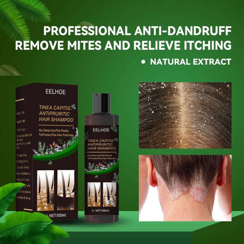 Anti-Dandruff Shampoo For Scalp Itching
