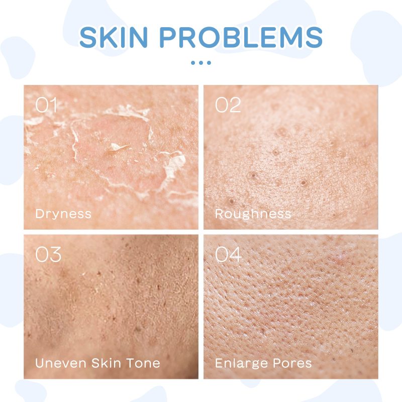 5-piece Milk Moisturizing Facial Care Suit - Image 4