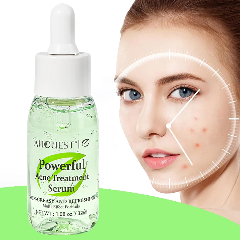 Herbal Acne Treatment Face Serum