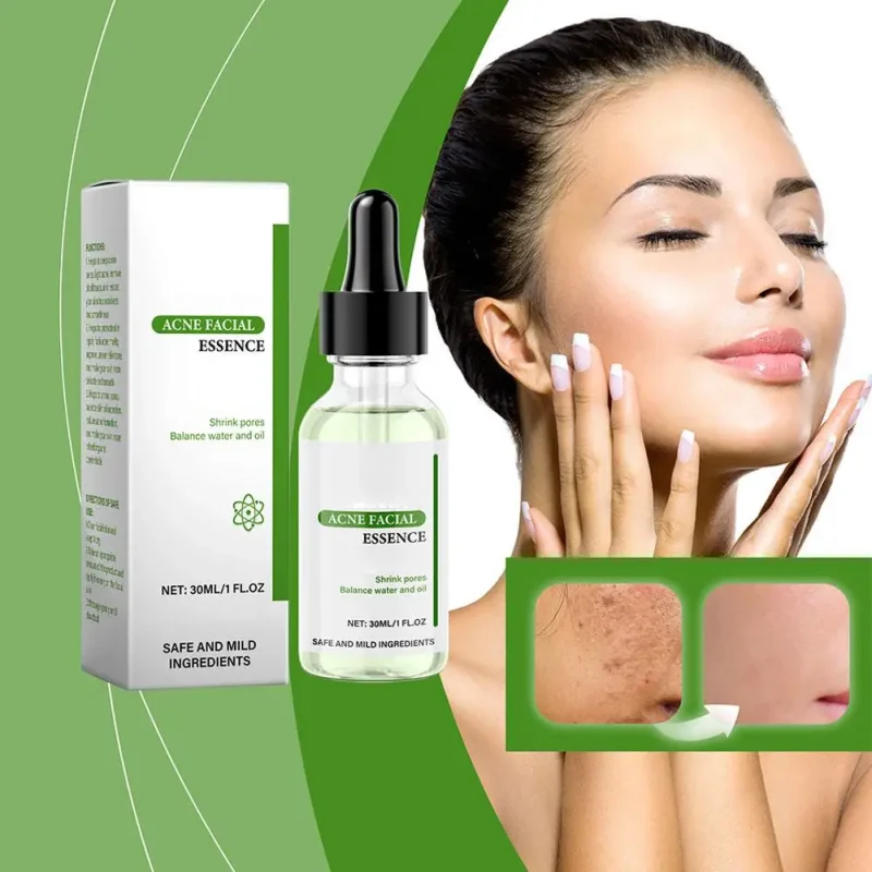 Acne Remover Shrinking Pore Serum